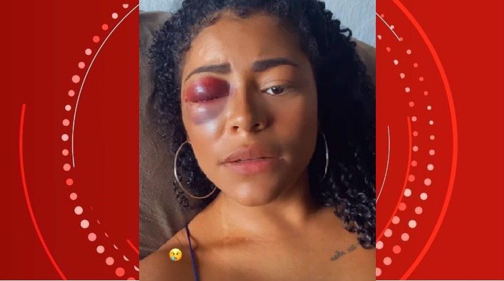 Raquel Brito mulher agredida namorado em Maceió — Foto: Reprodução/Instagram