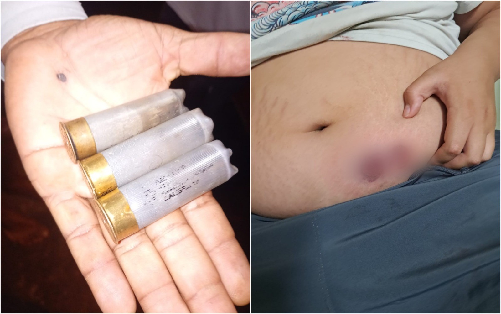 Adolescente autista é ferido durante ocorrência policial em Muzambinho
