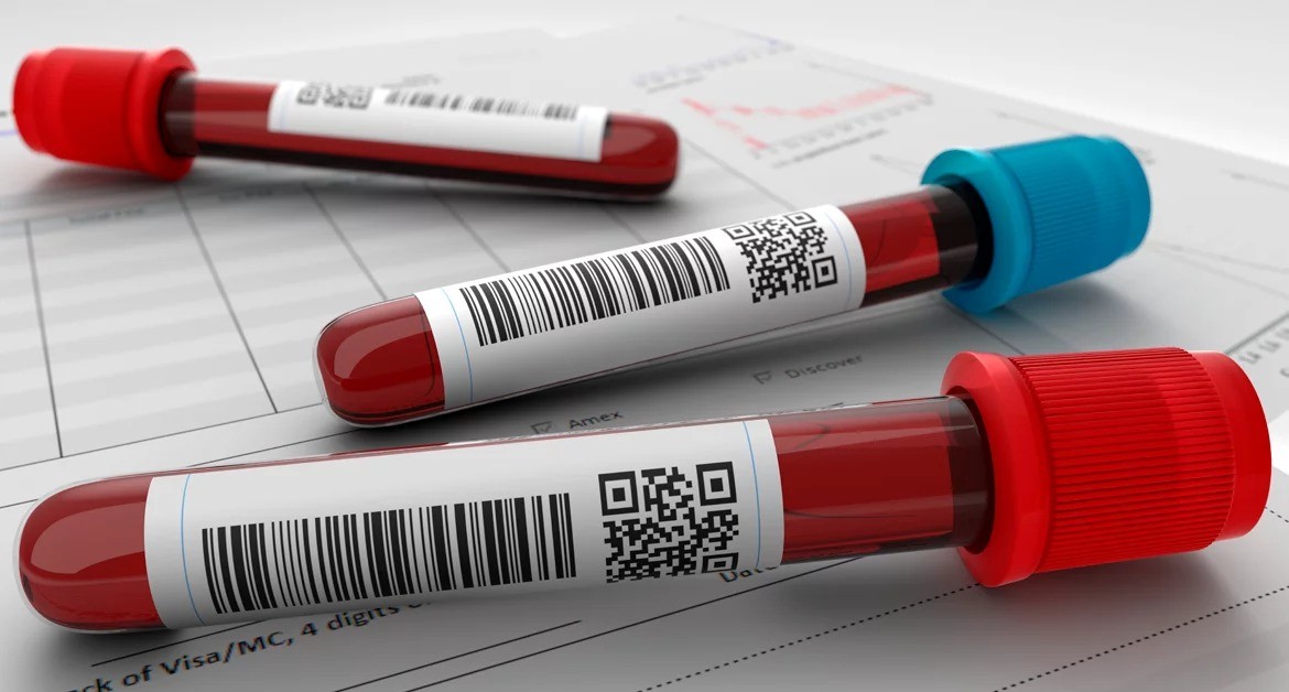 Faculdade de Medicina do ABC busca voluntárias para pesquisa de rastreamento de câncer de mama por exame de sangue; veja como participar
