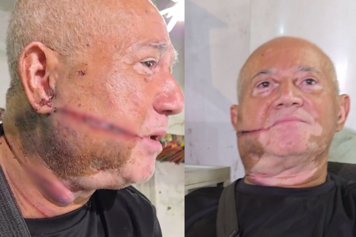 ‘Acordei com um facão no rosto’, conta dono de loja de rock de 71 anos atacado por ladrão em MS