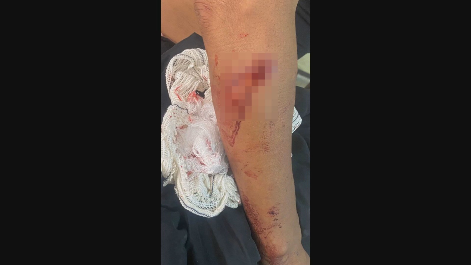 Mulher é atacada por matilha de cães no DF; veja VÍDEO