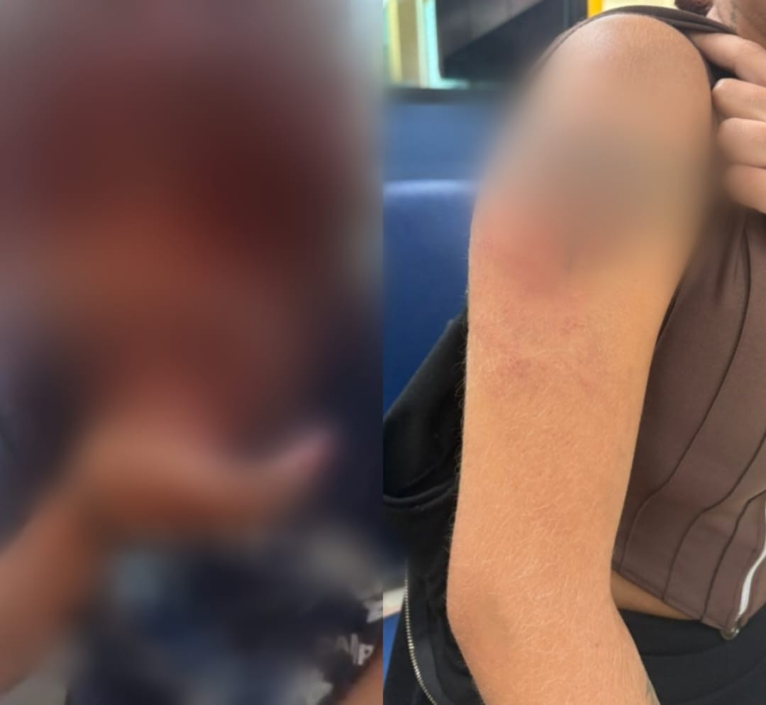 Mulher foge de cárcere privado após ser torturada pelo companheiro em Barra do Piraí; suspeito está foragido