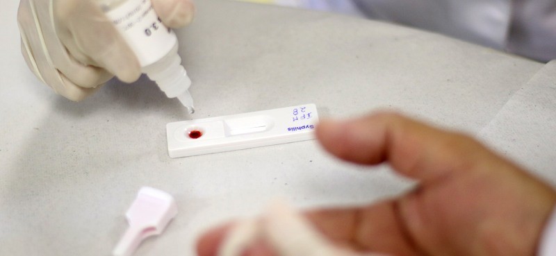 Sífilis congênita recua pela primeira vez em três anos, mas infecção cresce entre adultos acima de 40 anos