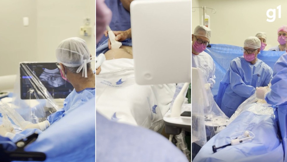 Médicos operam coração de feto com 29 semanas dentro da barriga da mãe em hospital do RS — Foto: Hospital Moinhos de Ventos/Divulgação