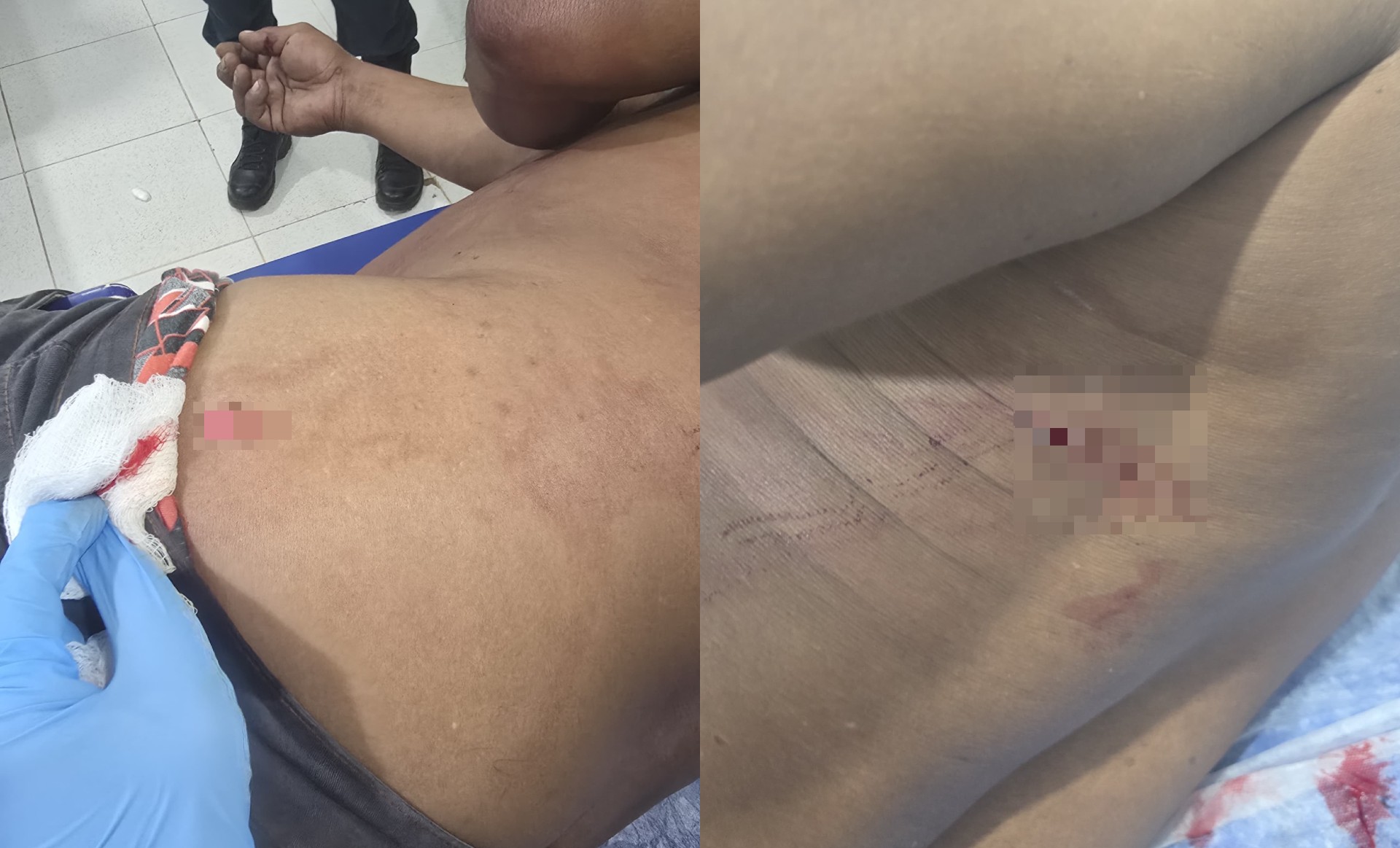 Homem é esfaqueado no peito e costas pela ex-mulher no Amajari