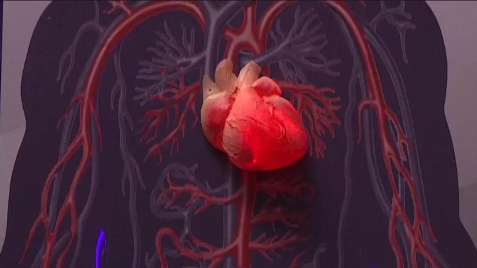 Como prevenir doenças cardíacas — Foto: Reprodução/RBS TV