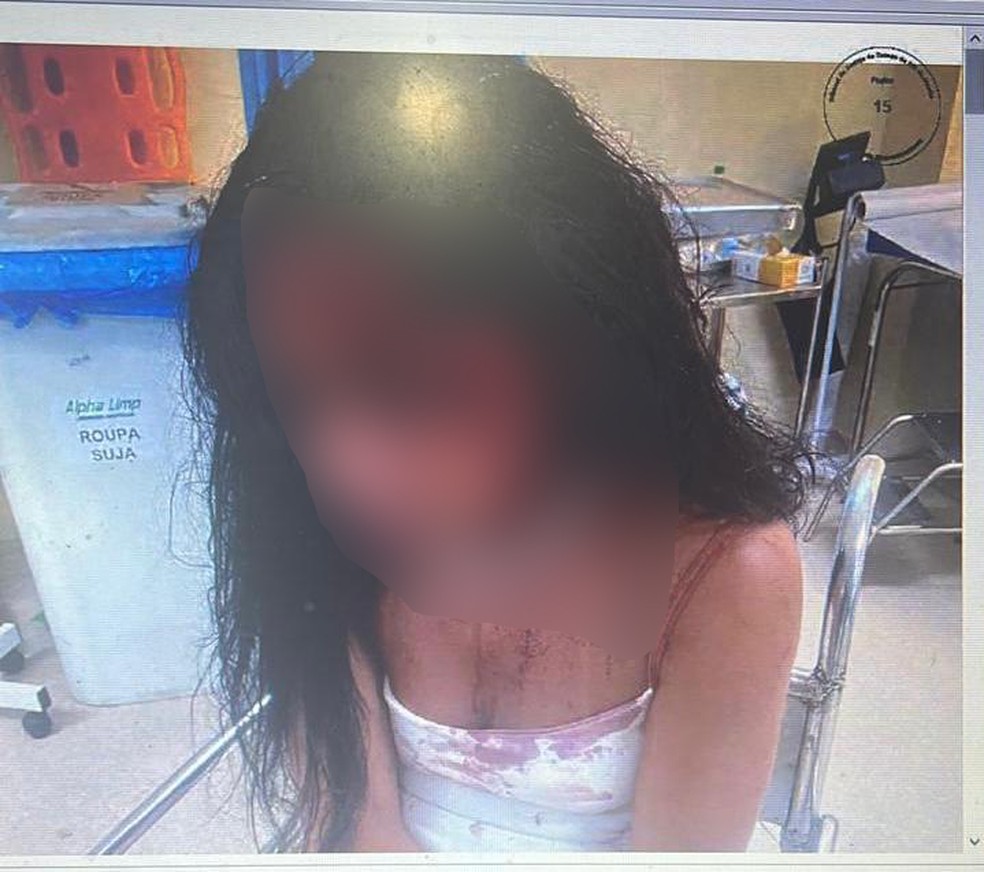 Mulher foi violentamente espancada pelo ex-companheiro em Campo Grande — Foto: Reprodução