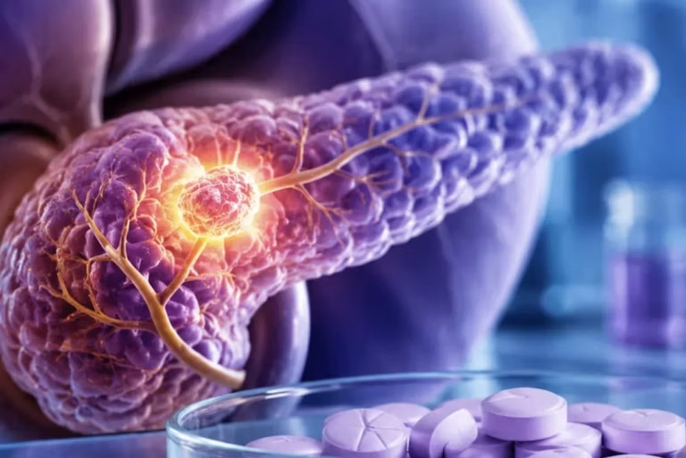 Novo medicamento para câncer de pâncreas quase dobra a sobrevida de pacientes em comparação à quimioterapia