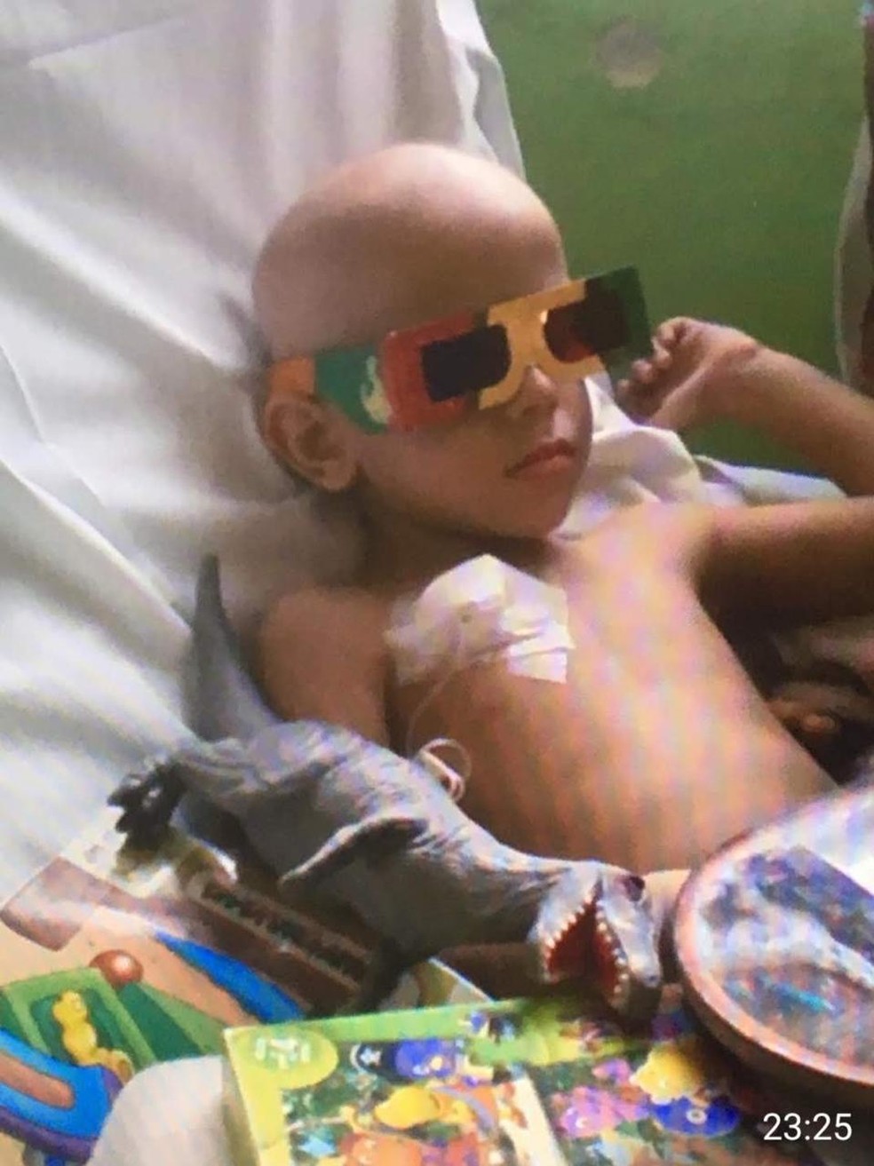 Luís Adolpho teve o primeiro tumor aos três anos — Foto: Arquivo Pessoal