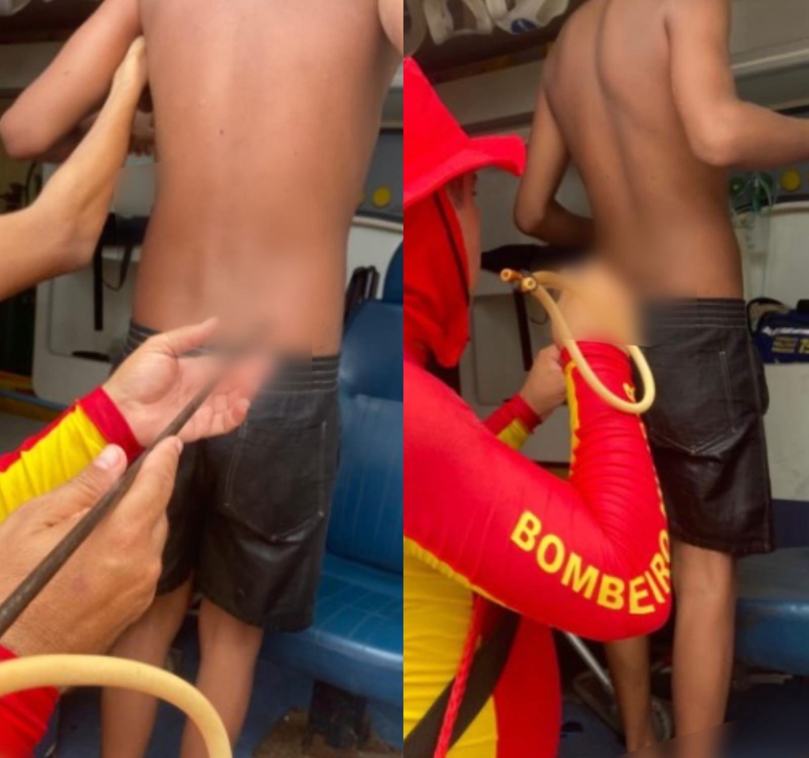 Adolescente é atingido por arpão durante pesca na Praia do Francês, em AL