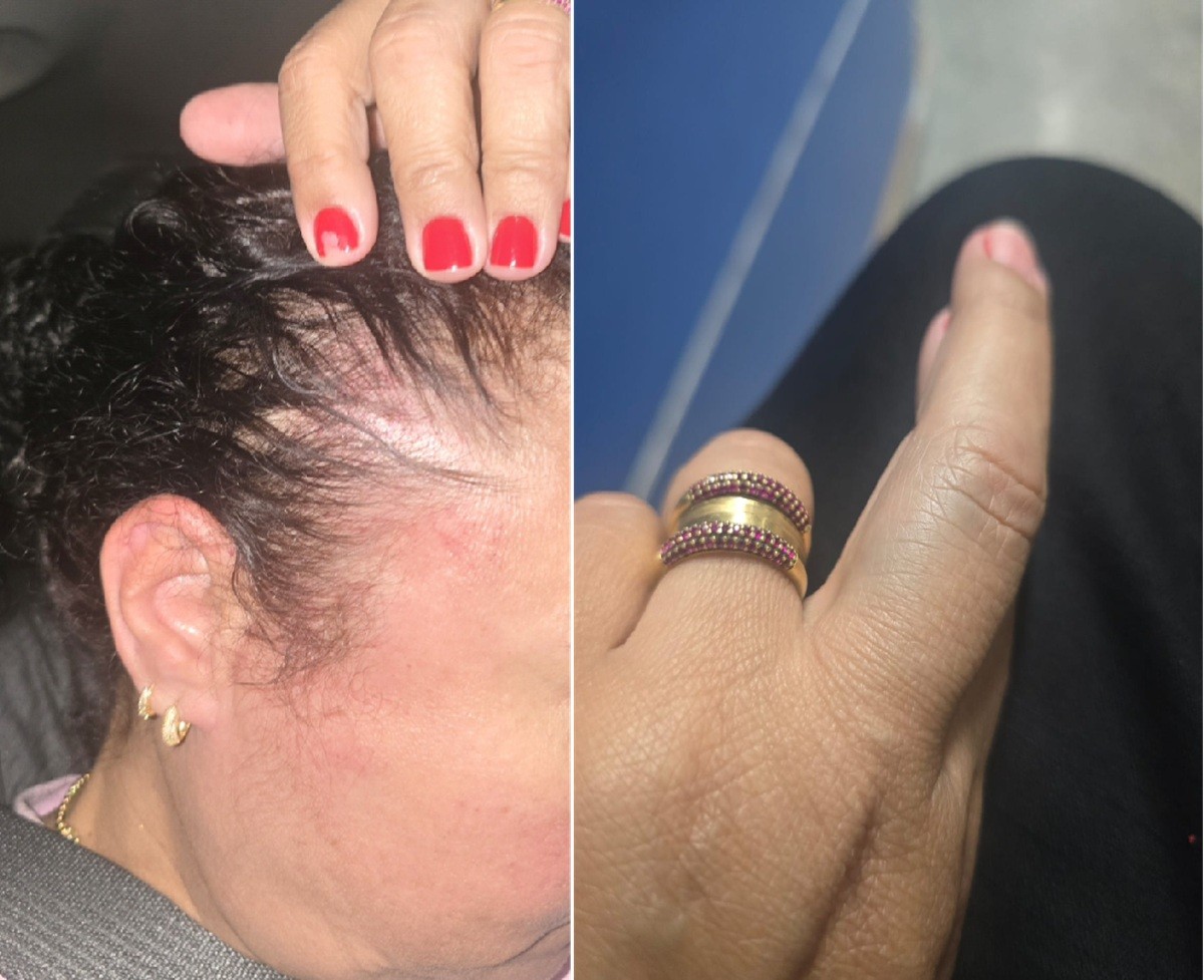 Mulher acusa genro, policial militar, de agressão durante aniversário do neto em Iguaba Grande 