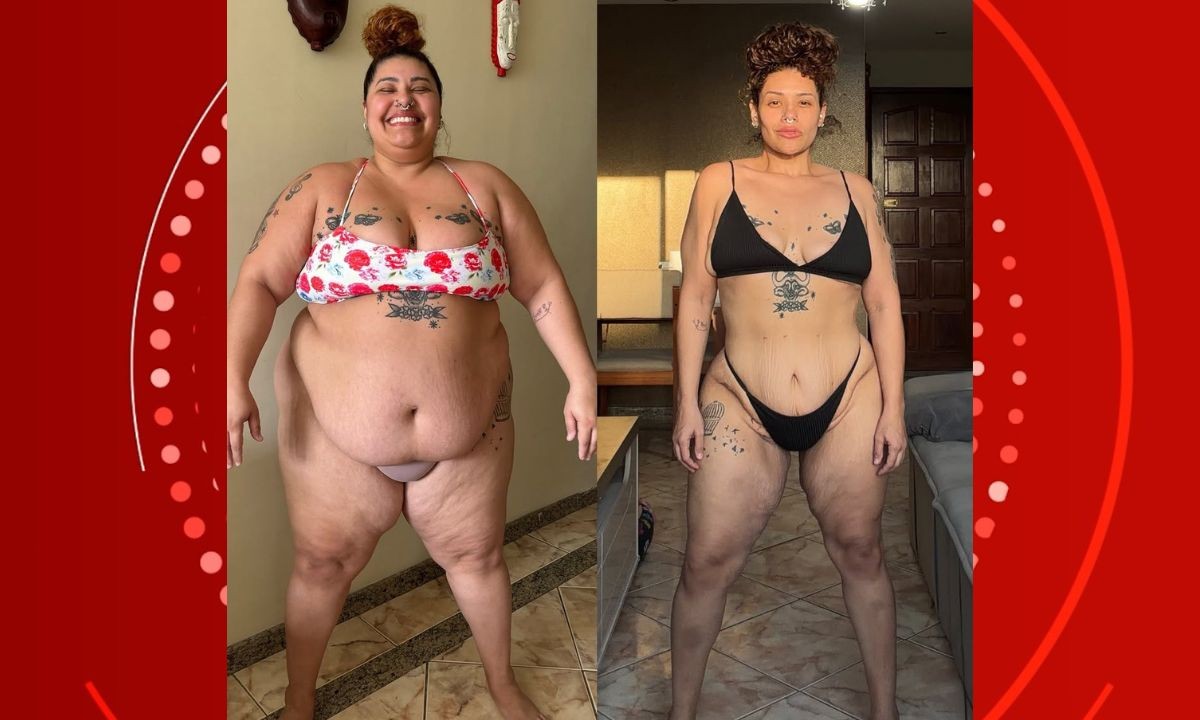 Ex-The Voice Brasil Aila Menezes mostra antes e depois de perder 90 kg com cirurgia bariátrica 