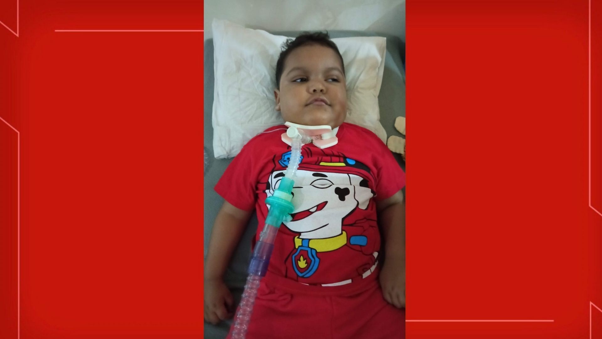 Menino picado por escorpião tem piora e busca tratamentos