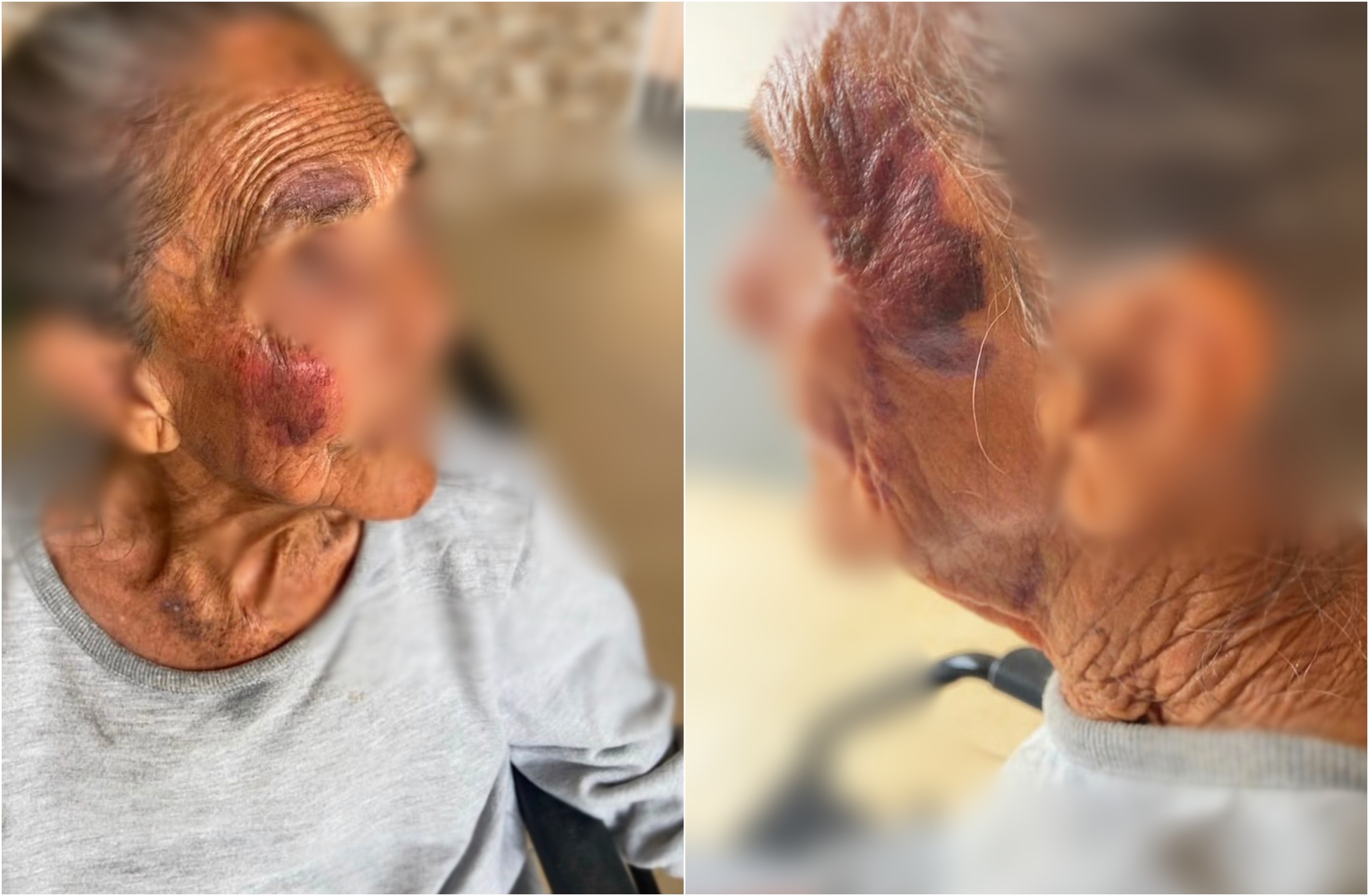 Idosa de 96 anos é resgatada com suspeita de maus-tratos em Salto de Pirapora