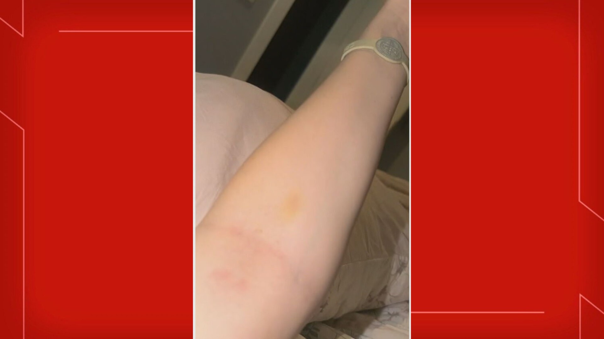 Jovem de 18 anos denuncia ter sido abusada em festa no Setor de Clubes Sul, em Brasília