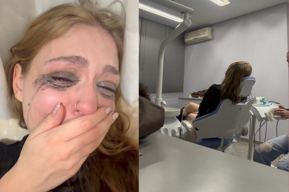 Com rímel borrado de tanto chorar, Eduarda procurou a amiga dentista que a atendeu de madrugada — Foto: Redes sociais