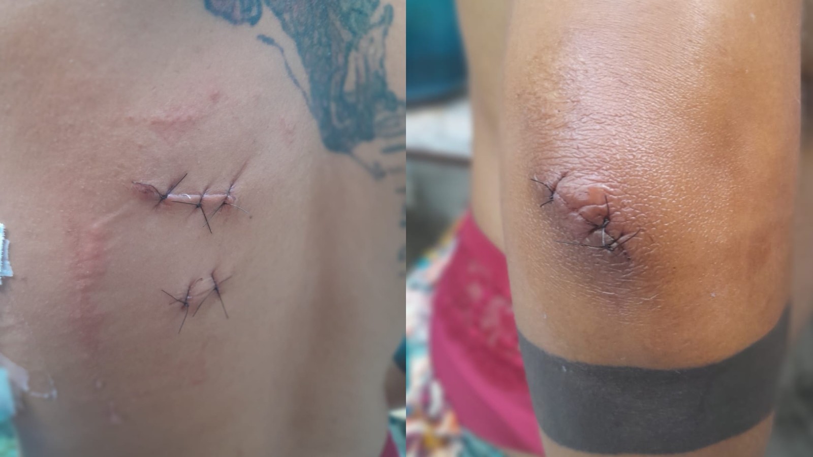 Homem é condenado a 29 anos de prisão por tentar matar mulher grávida a facadas no Ceará