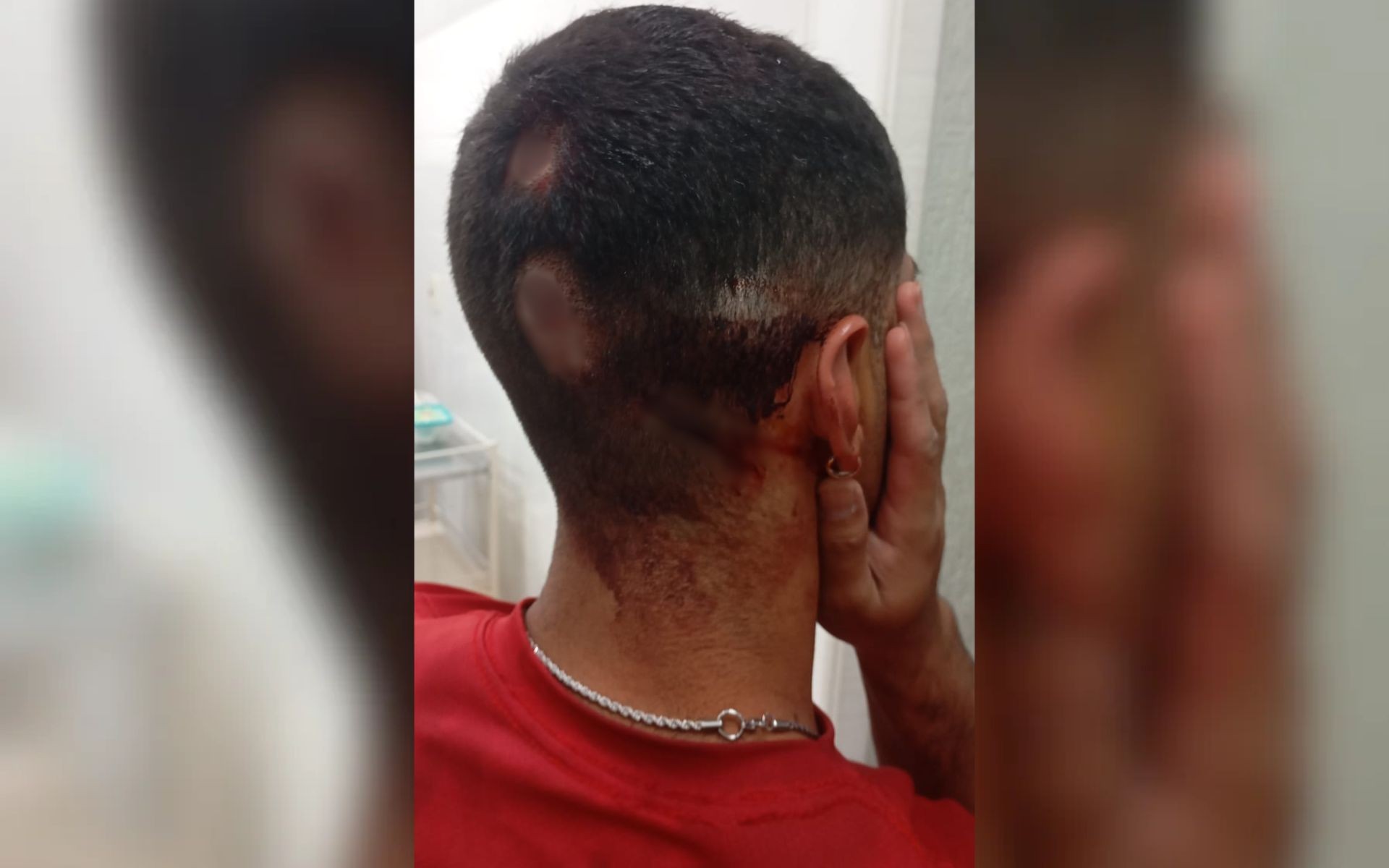 Jovem é agredido por grupo vestido de verde e amarelo ao comemorar vitória de Lula em praça; vídeo