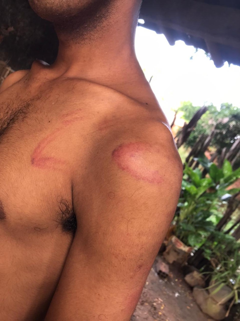 Estudante é retirado de escola e torturado em matagal no interior do PI; vítima denuncia dois policiais — Foto: Reprodução