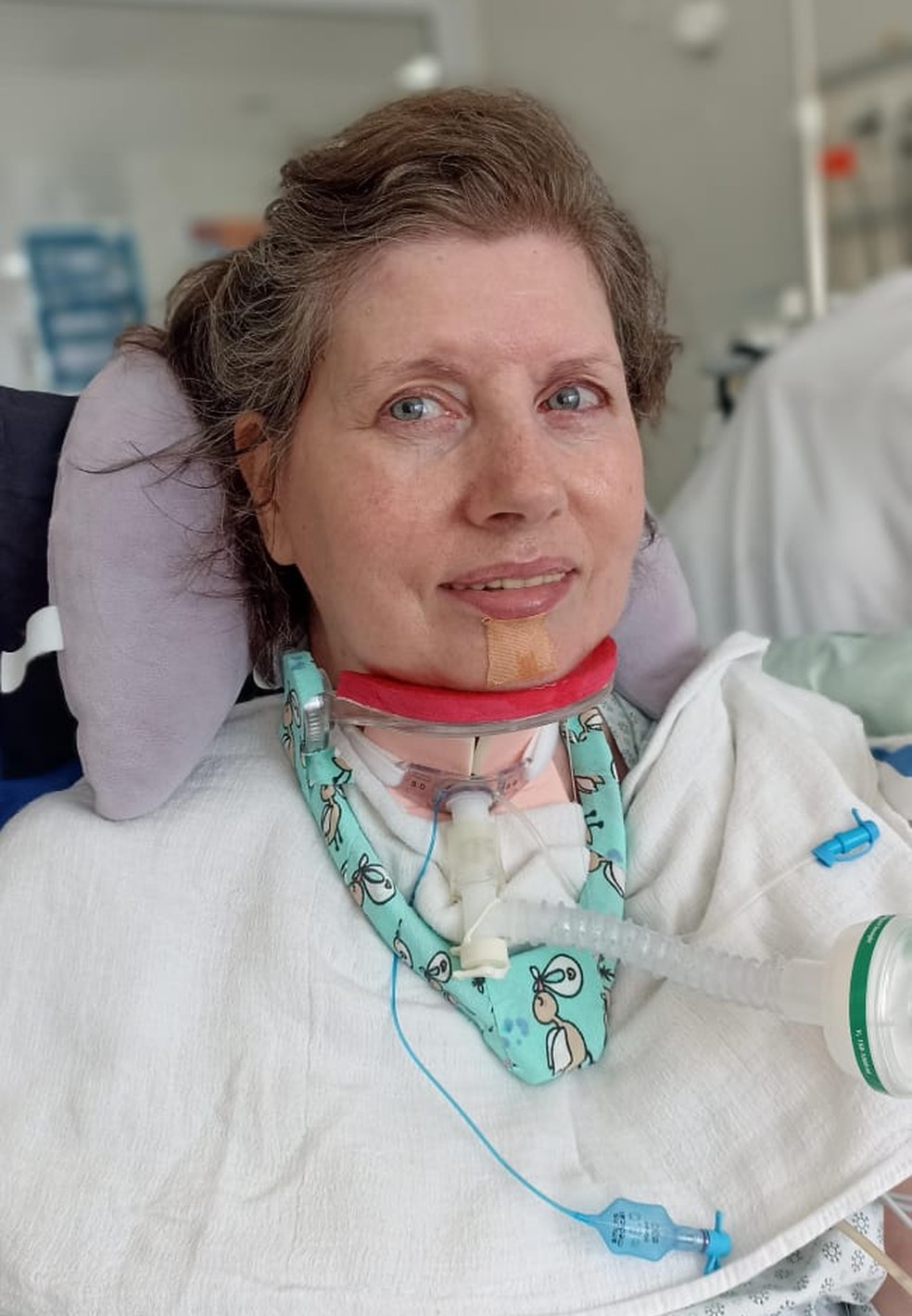 Izabel, a Bela, está na UTI há 150 dias — Foto: Arquivo Pessoal