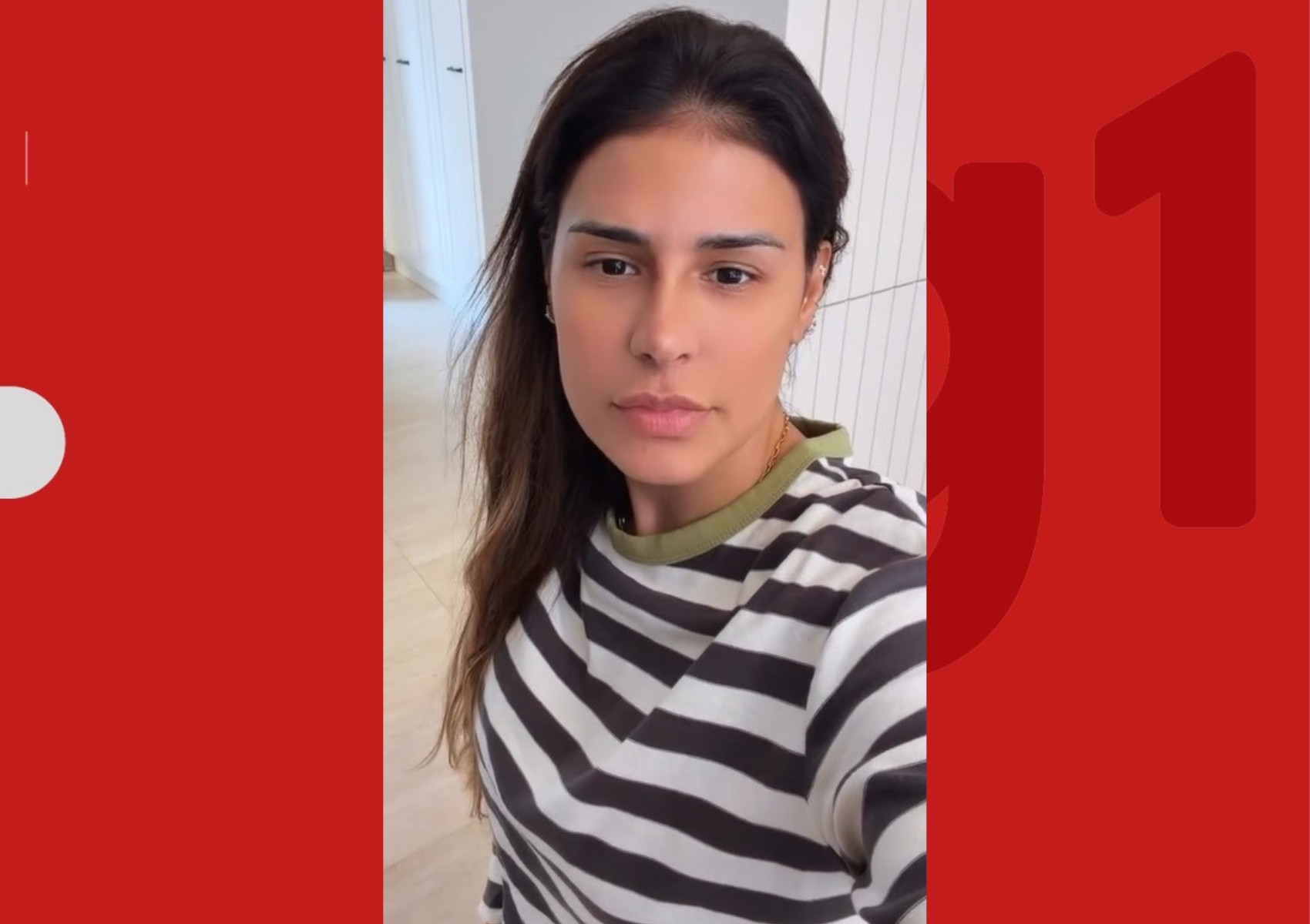 Simone Mendes surge sem curativos e exibe resultado de procedimento no nariz