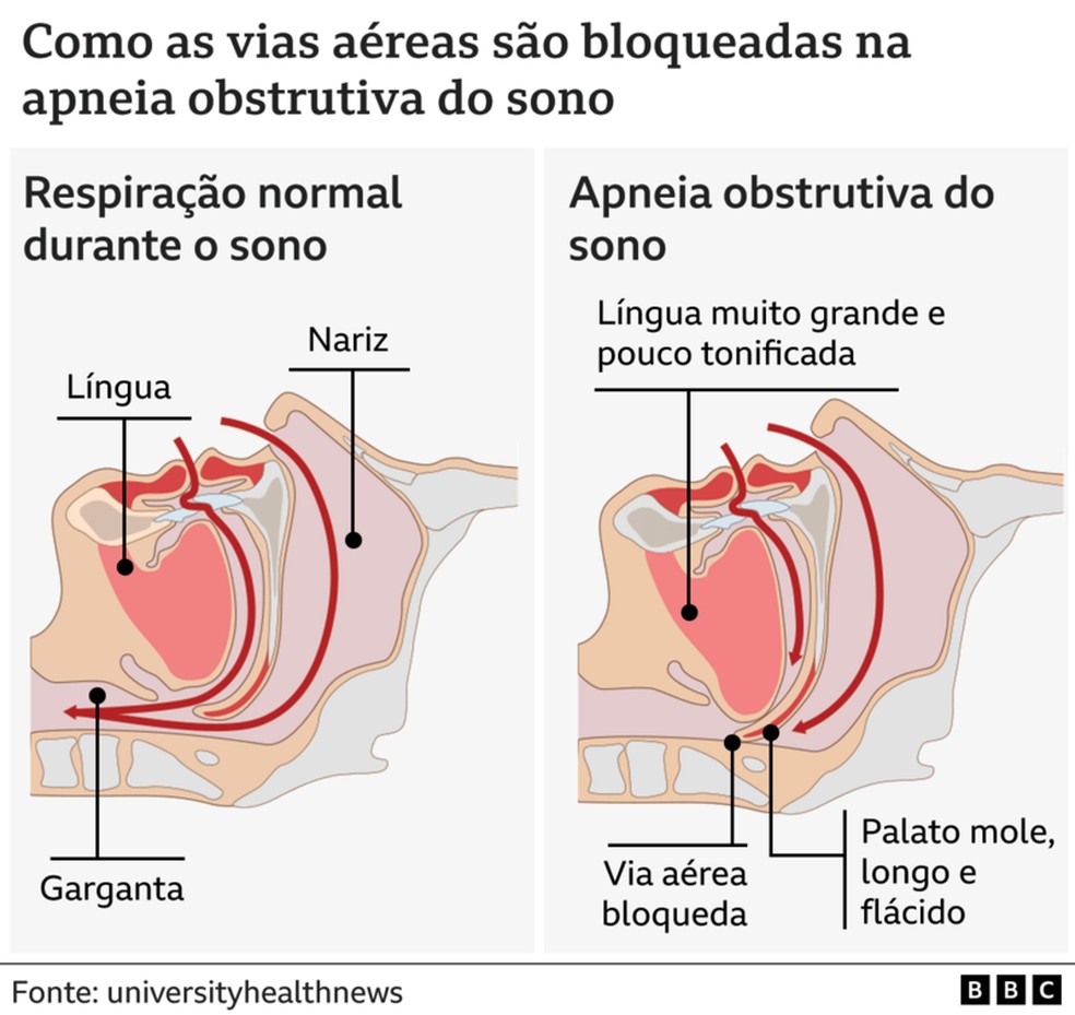  — Foto: BBC