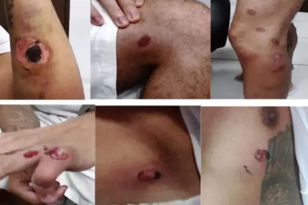 Ferimentos causados em detentos, conforme relatório de inspeção — Foto: Reprodução