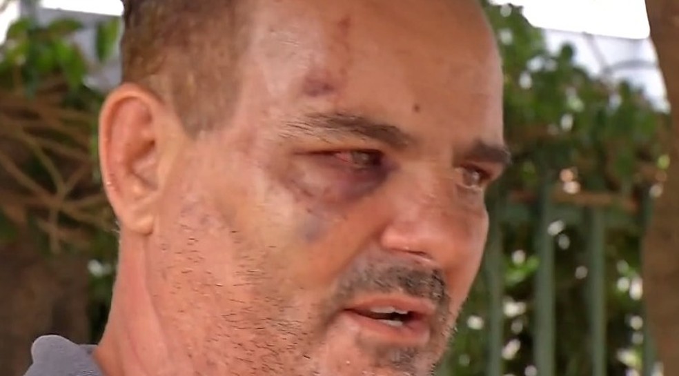 Homem tentava ajudar o filho quando foi atacado — Foto: TV Centro América