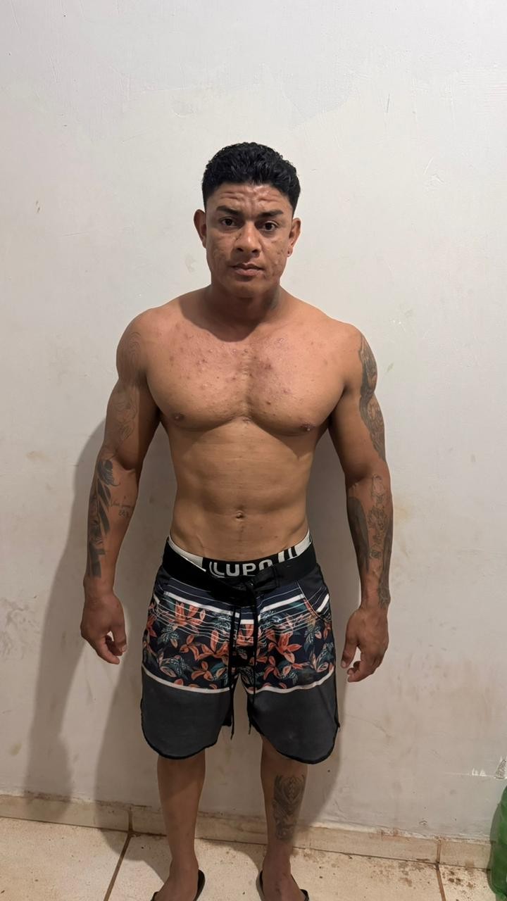 Mulher fica em estado gravíssimo após ser espancada com socos e chutes pelo companheiro em Tomé-Açu