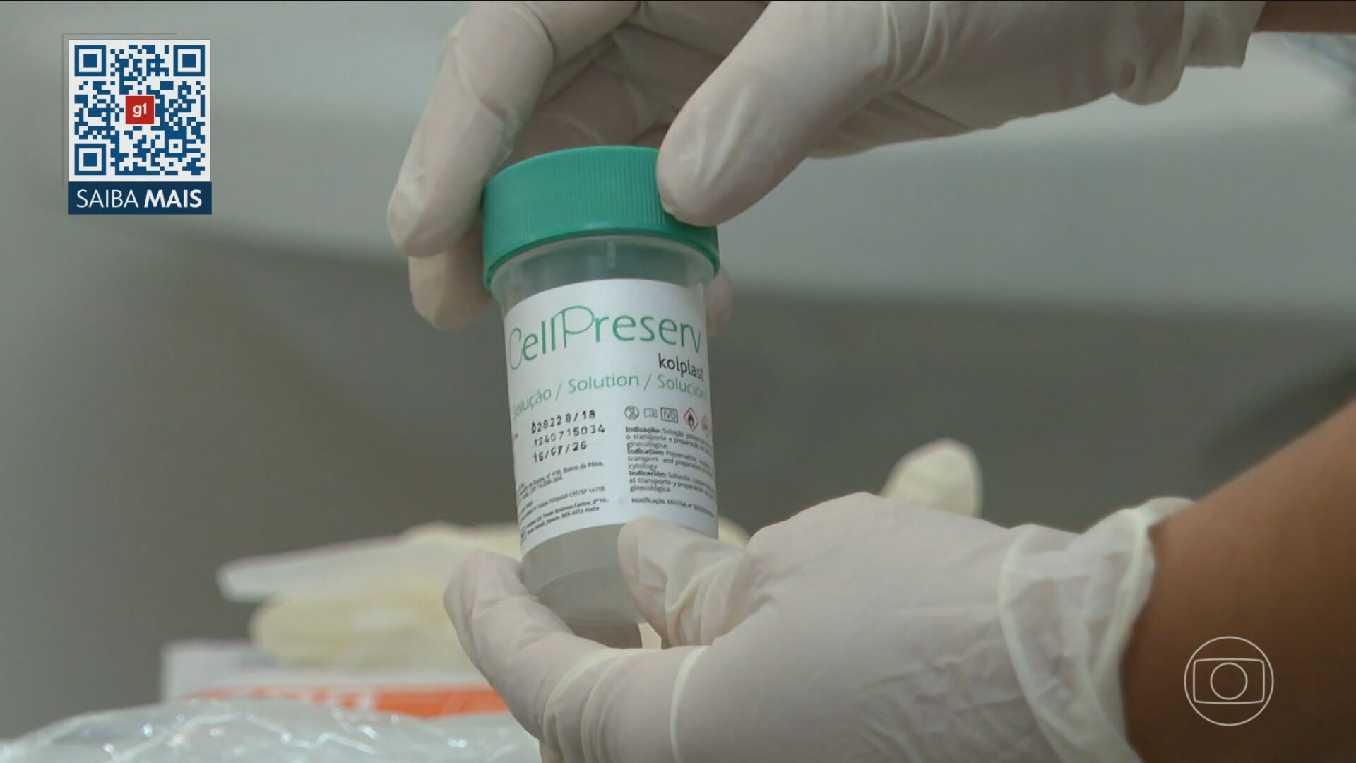 SUS começa a oferecer exame mais eficiente, que usa tecnologia brasileira, para detecção do vírus HPV