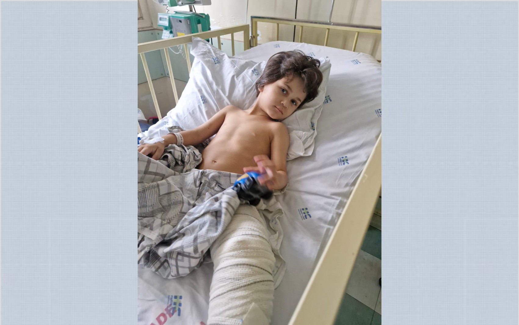 Menino que sobreviveu após cair do 10º andar de prédio no interior de SP passa por terceira cirurgia e se recupera bem