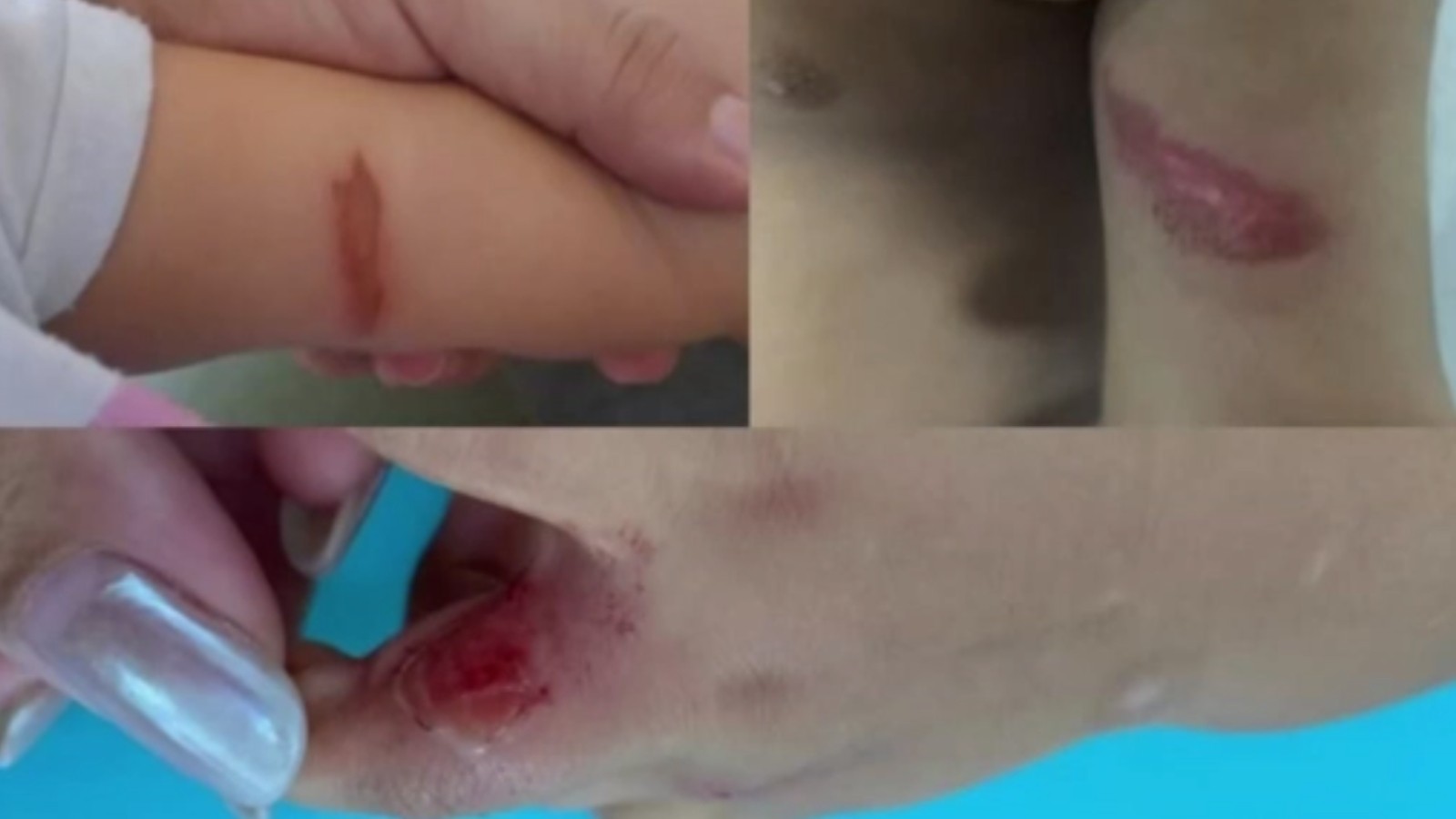 Escola infantil suspende aulas após bebês sofrerem infecções em Fortaleza