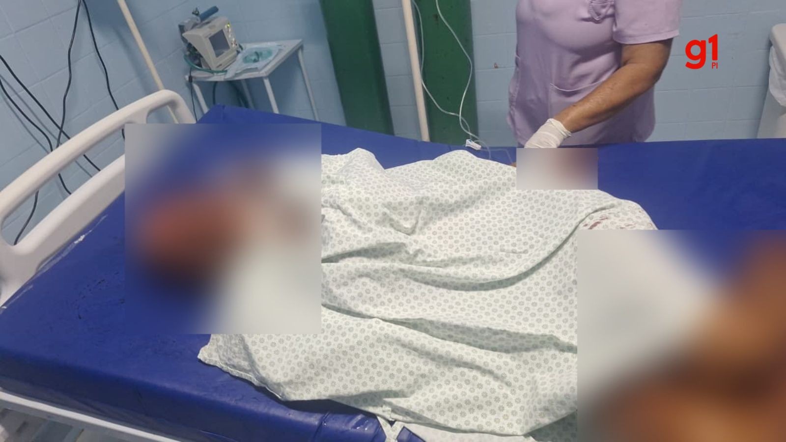 Mulher fica gravemente ferida após ser atacada a facadas no Norte do Piauí