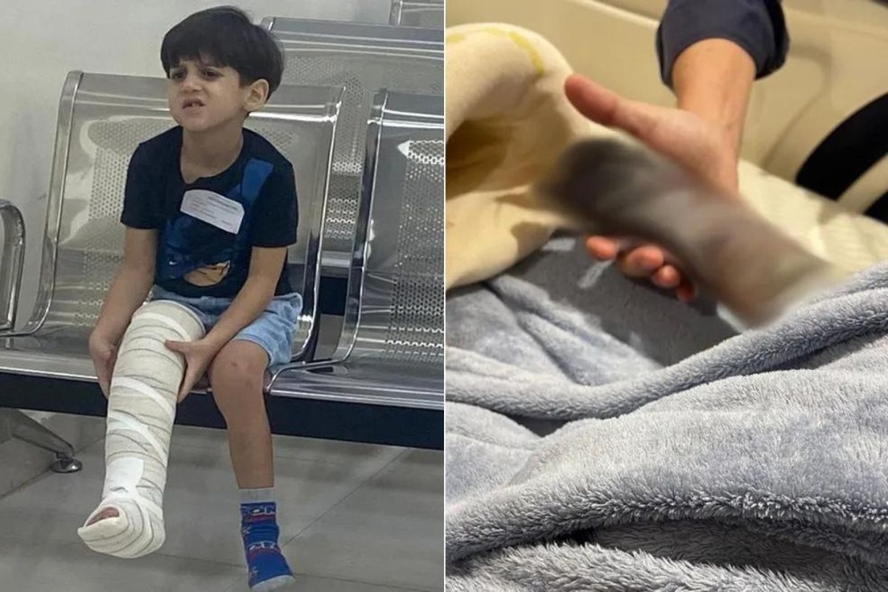 Famosos manifestam apoio na web a menino que teve perna recuperada após condenação à amputação — Foto: Arquivo pessoal