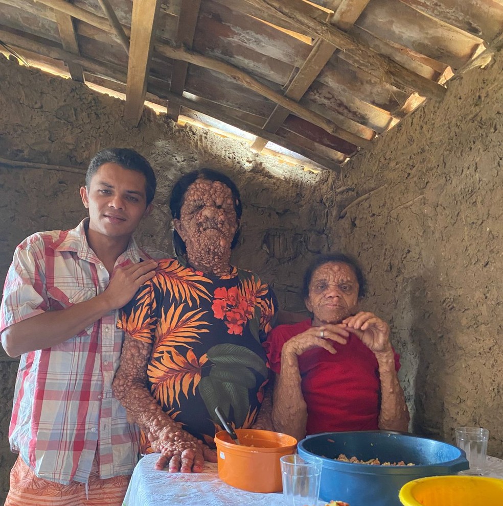 Filho de mulher que tem doen�a rara criou rede social para compartilhar hist�ria � Foto: Arquivo Pessoal / Edilson Filho