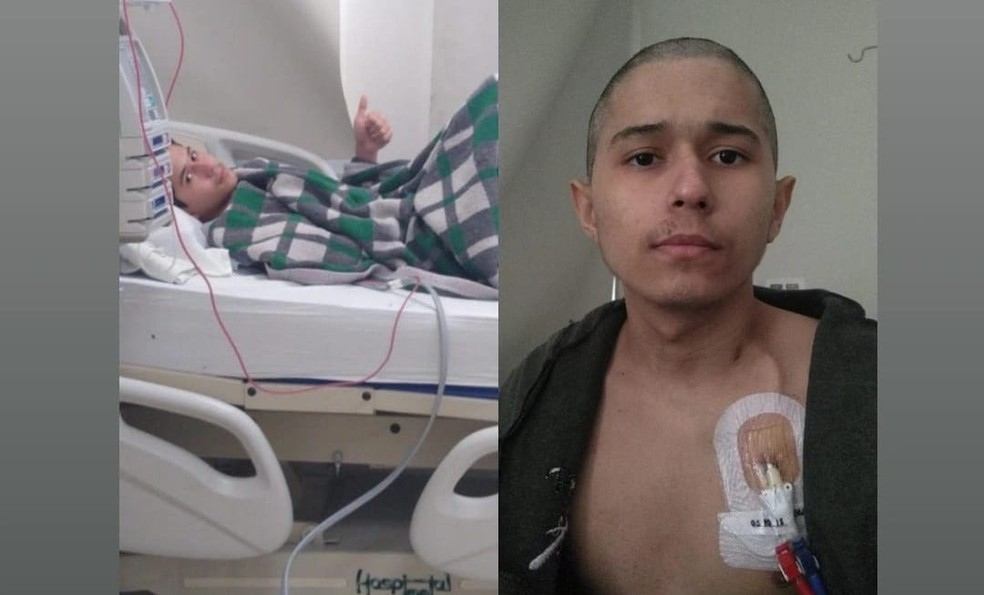 Jovem universitário foi diagnosticado com leucemia aos 12 anos, no Ceará. — Foto: Arquivo pessoal