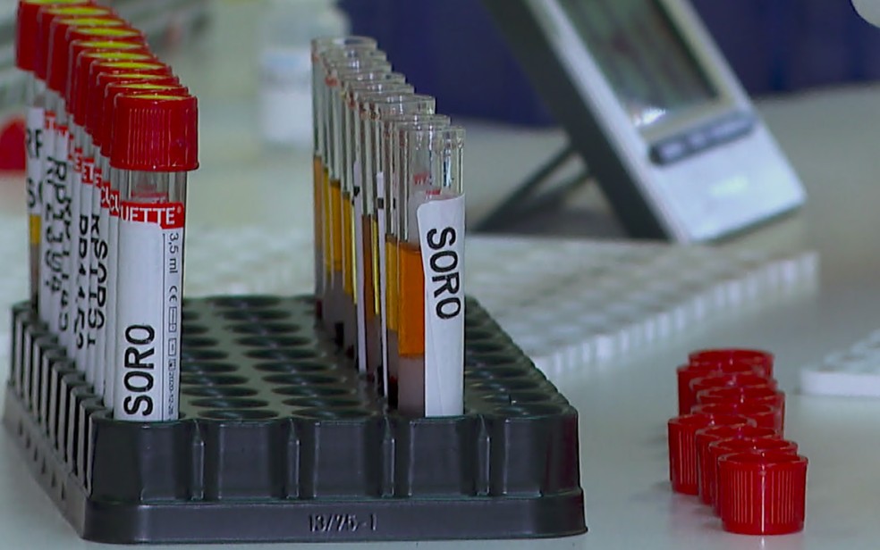 Exame para diagnóstico de dengue  — Foto: Reprodução/EPTV