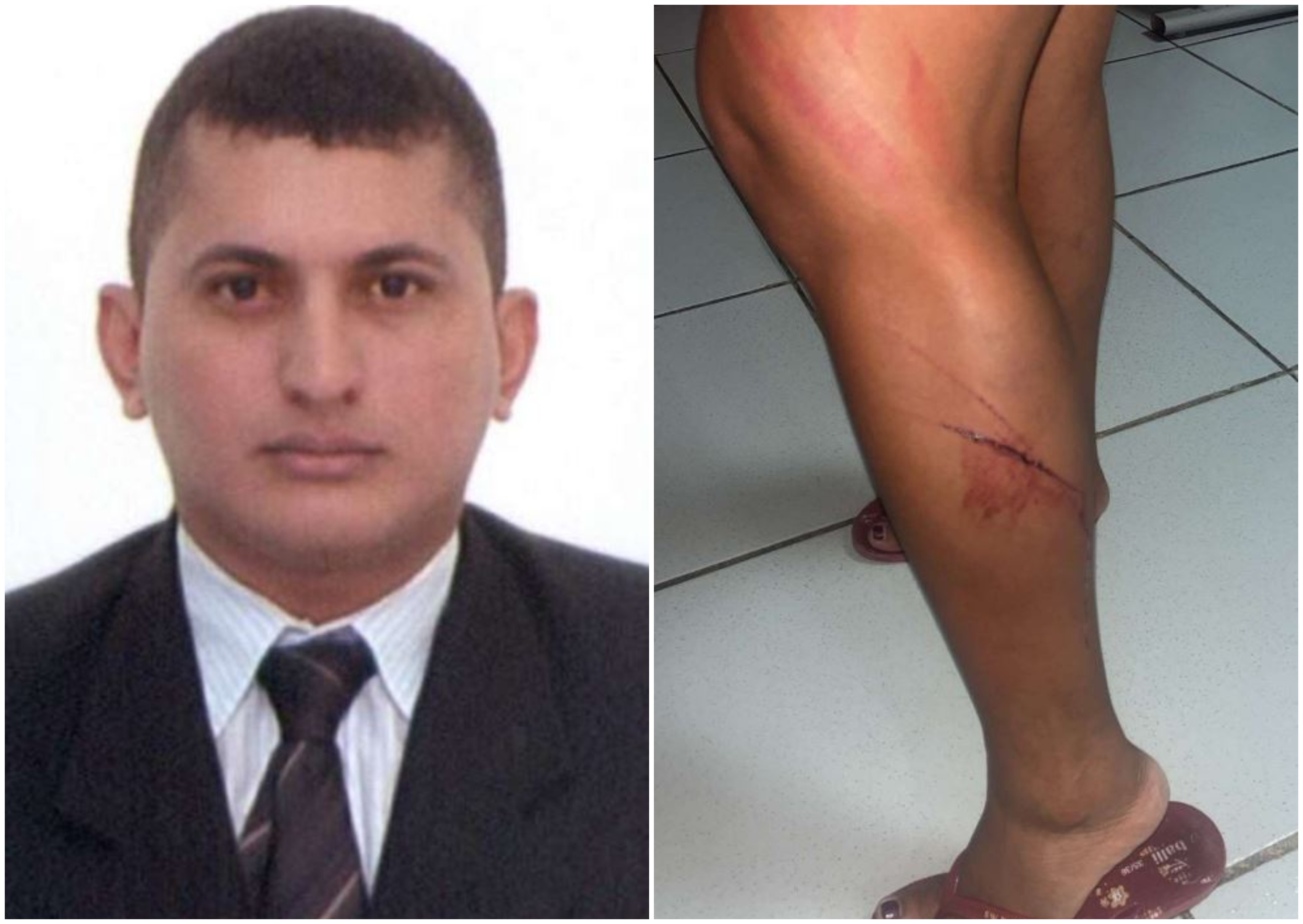 Advogado suspeito de agredir ex com madeira é denunciado à Justiça por violência doméstica, roubo e injúria