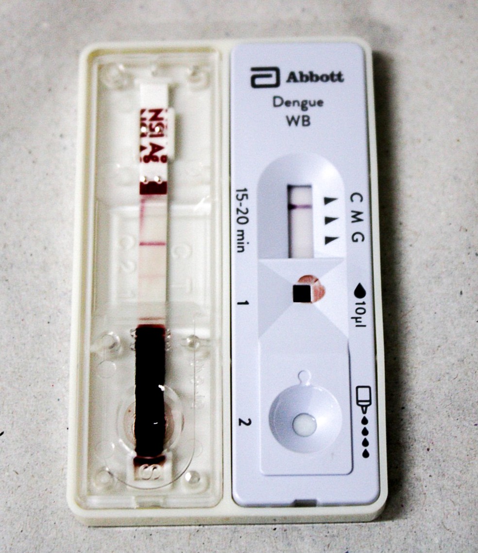 Teste rápido de dengue em uma UBS de São Paulo, em abril de 2024 — Foto: Raul Luciano/Ato Press/Estadão Conteúdo