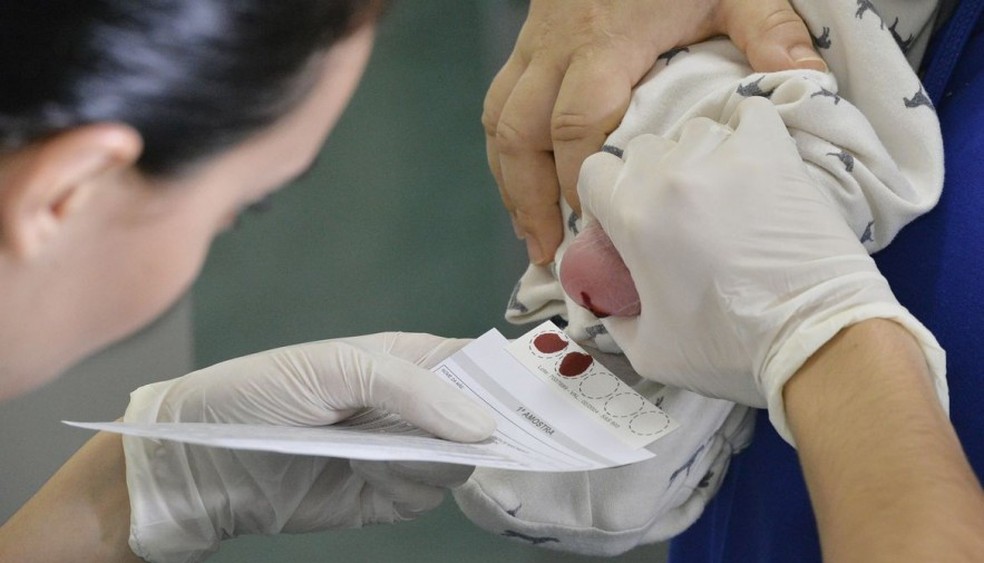 O teste do pezinho é um direito garantido por lei — Foto: Agência Brasil/Divulgação