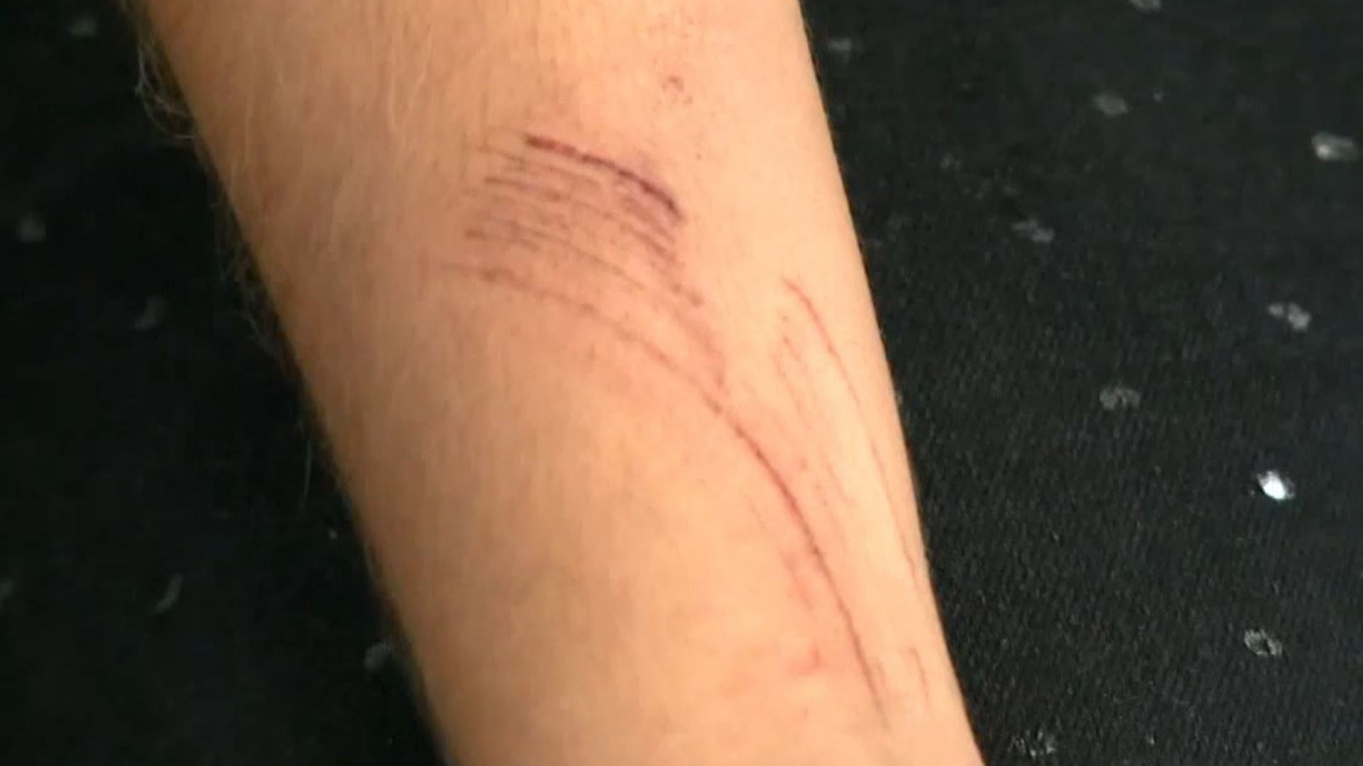 Para fugir de tiros do marido, mulher pula do 2º andar com duas meninas de 10 e 14 anos no ES