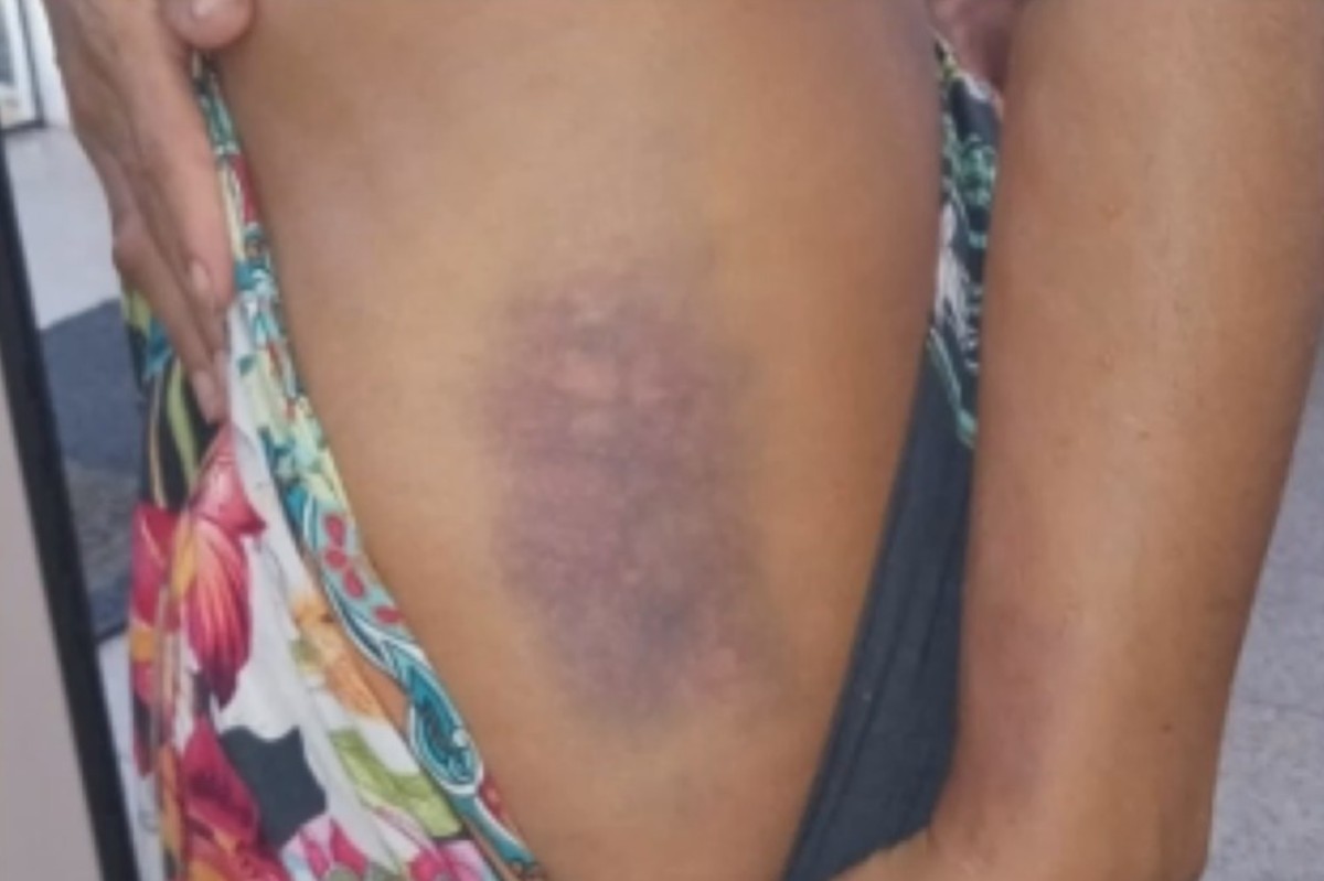 Mulher é espancada pelo ex-companheiro em Caraíva, distrito turístico da Bahia 