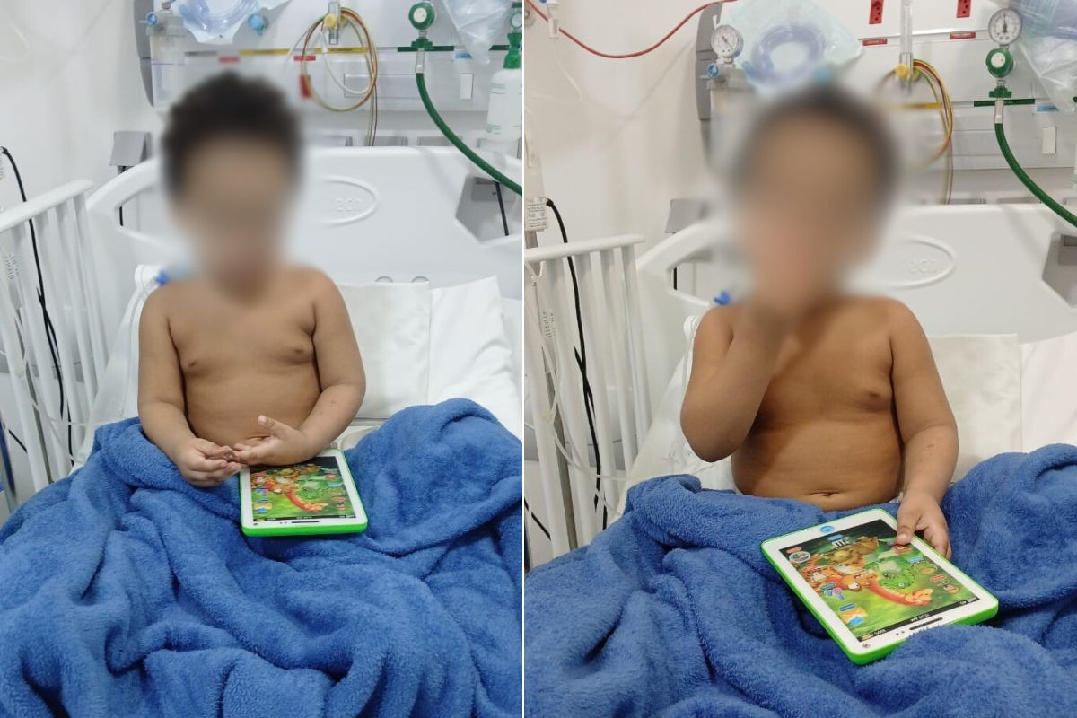 Menino espancado pelo padrasto recebe alta médica após intubação e coma no litoral de SP