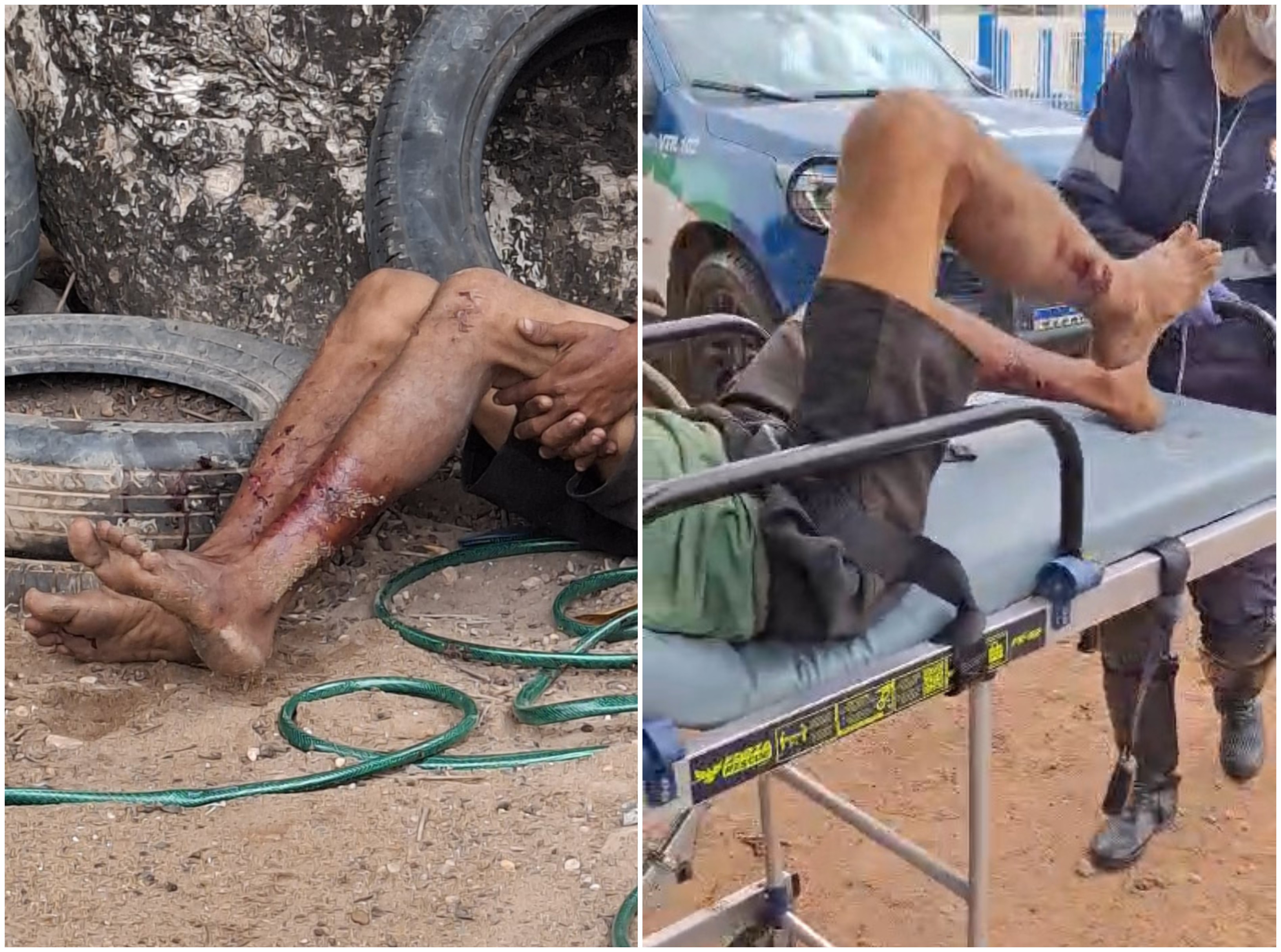 Ladrão em fuga pula muro de casa e é atacado por cachorro em Boa Vista