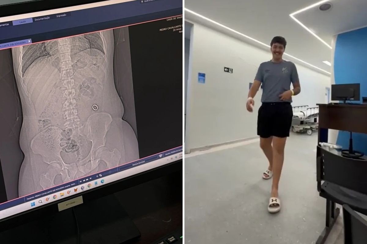 Entenda: Jovem engole aliança sem querer, vai parar no hospital e viraliza na web; VÍDEO