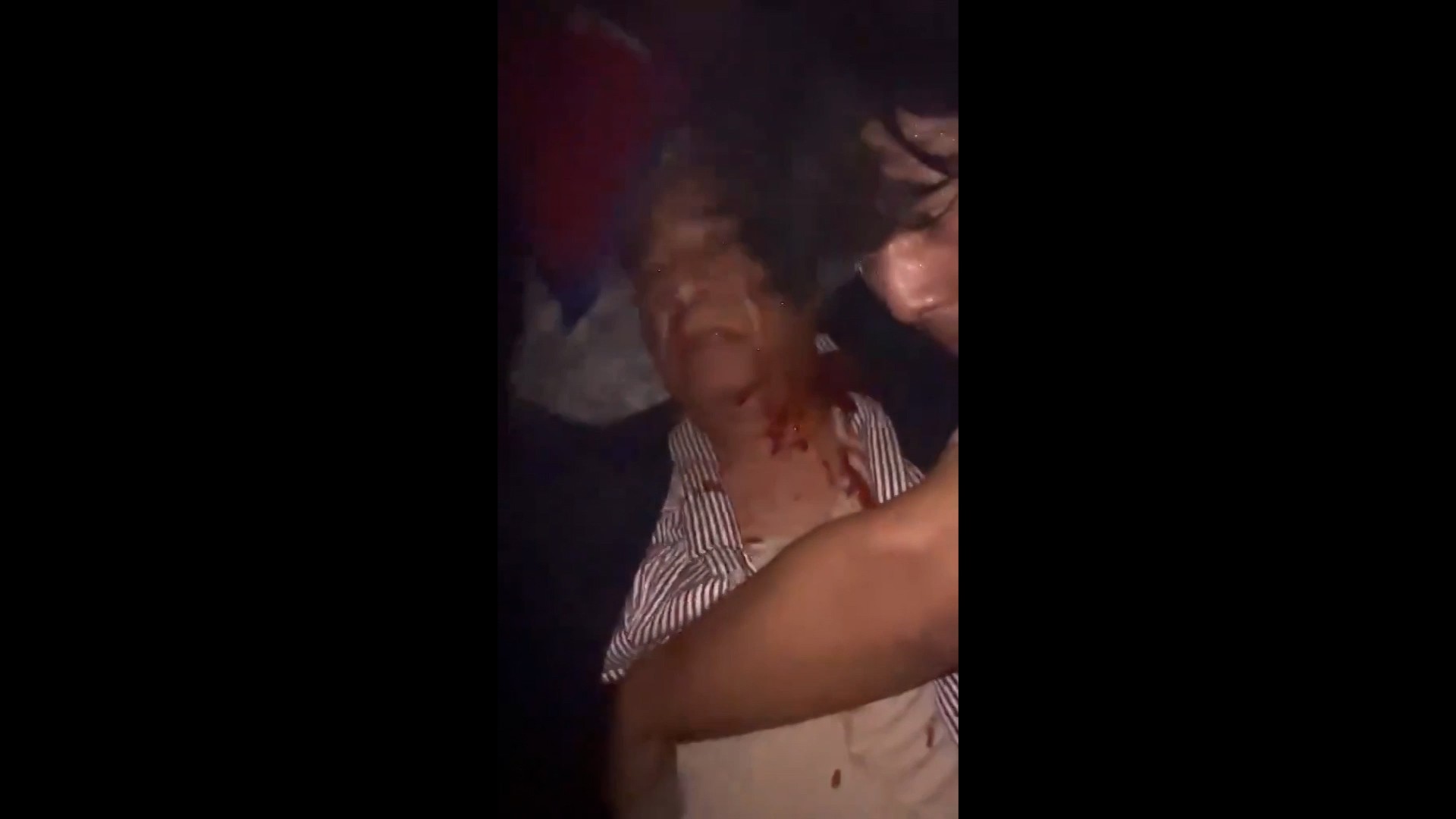 Cenas de brutalidade no Nepal: ministra e marido são agredidos após ter casa invadida