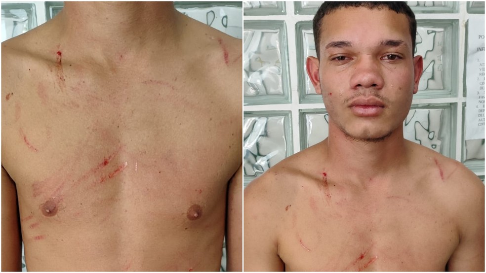 Suspeito de matar influenciadora enforcada com cinto de segurança estava com diversos arranhões pelo corpo. — Foto: Reprodução