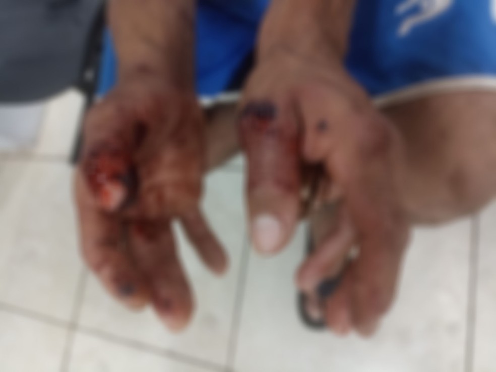 Homem mata cachorra com golpe de faca após ser atacado, em Presidente Prudente (SP) — Foto: Polícia Civil