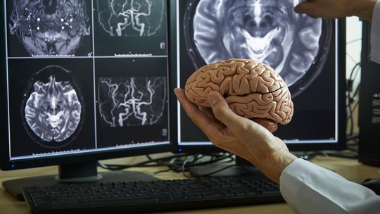 Neurônios não morrem: o enigma do envelhecimento cerebral pode mudar tratamento de Alzheimer e Parkinson -
Sequenciamento de células do córtex pré-frontal revela mutações somáticas e queda de genes de manutenção após os 40 anos; achado pode redefinir prevenção e abrir caminho para novas terapias contra Alzheimer e Parkinson.