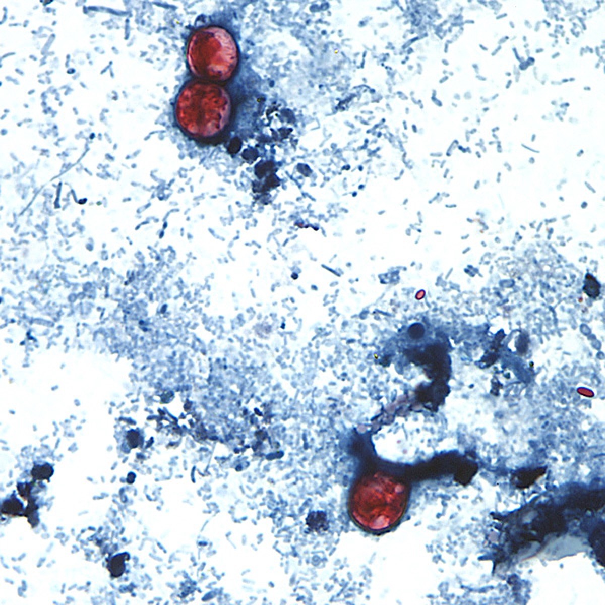 Parasita que provoca 'diarreia explosiva' infecta mais de 2,8 mil pessoas nos EUA; investigação aponta alface como suspeita